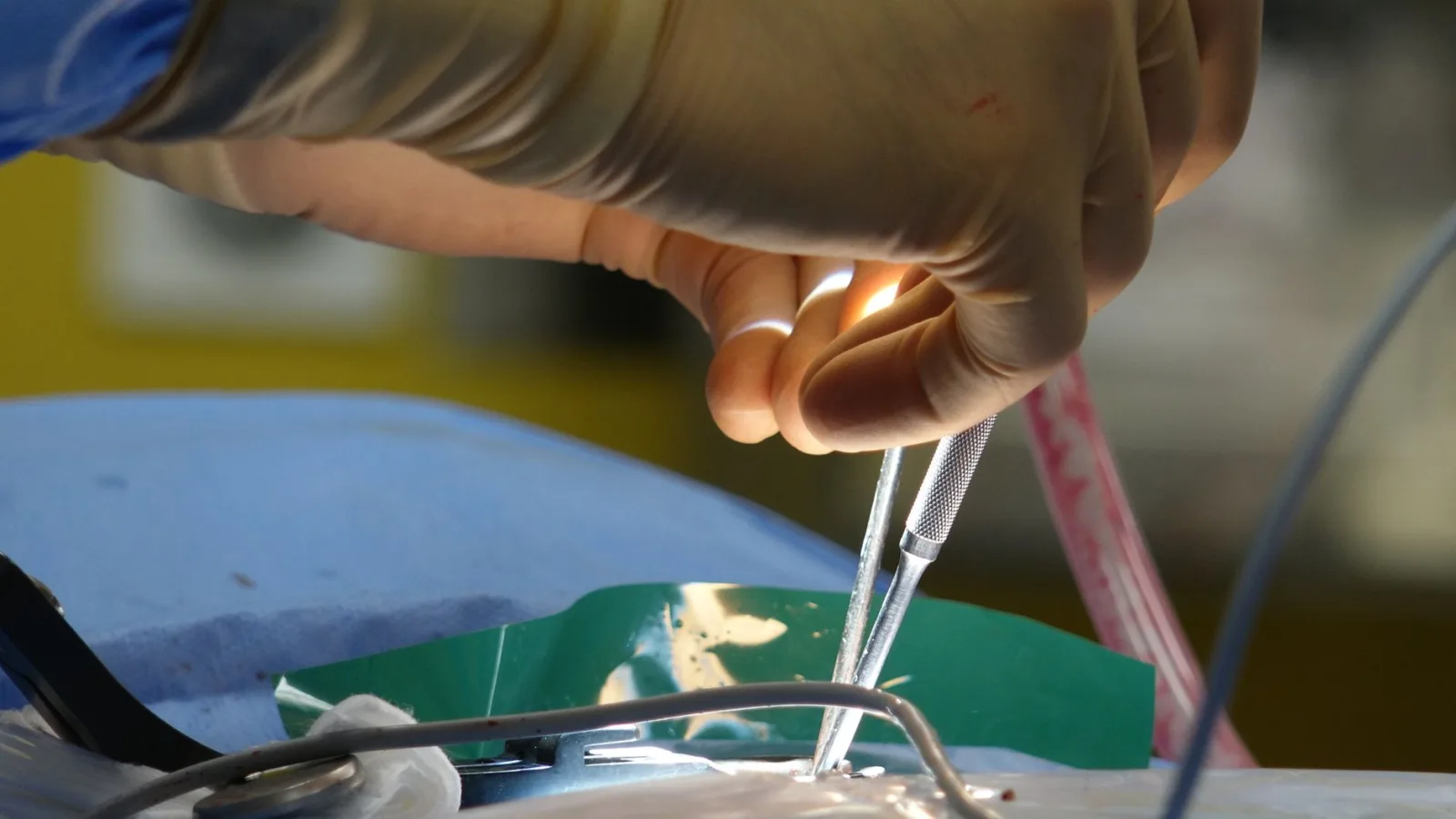 Scientists Uncover Hidden Immune Signal Key to Spinal Cord Regeneration